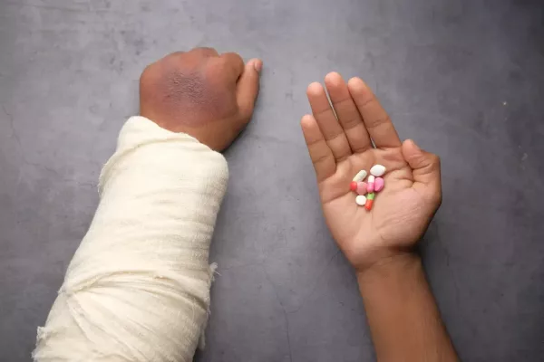 Left arm in cast with right hand holding pills