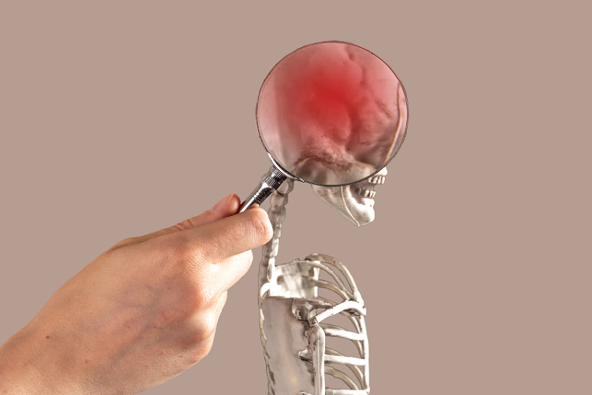 How to Recover From Chronic Concussion Syndrome